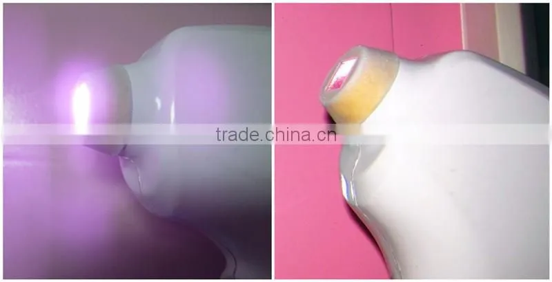 Deep color hair removal 808nm diode laser