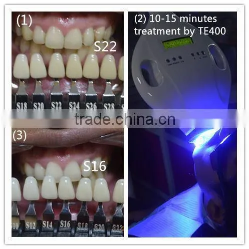 Factory Direct Wholesale Price Blue LED Lights Teeth Whitening Machine for Whitening Teeth