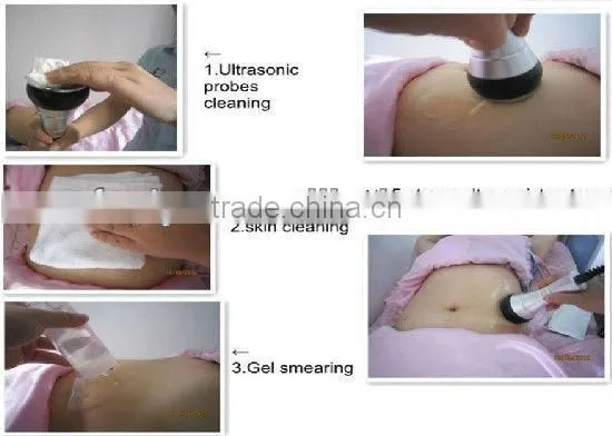 Professional 3 in 1 fat freezing liposuction home use machine for sale