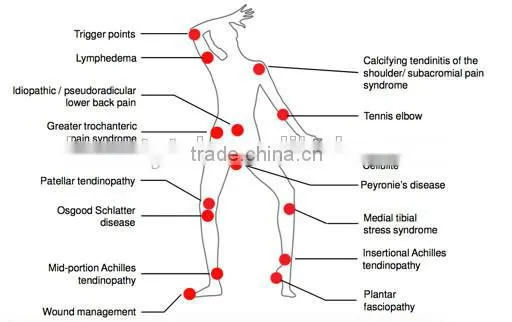 TSL beauty effectice relieve pain shock wave therapy machine for cellulite removal