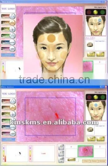 Intelligent Skin Diagnosis protable Skin Analyzer