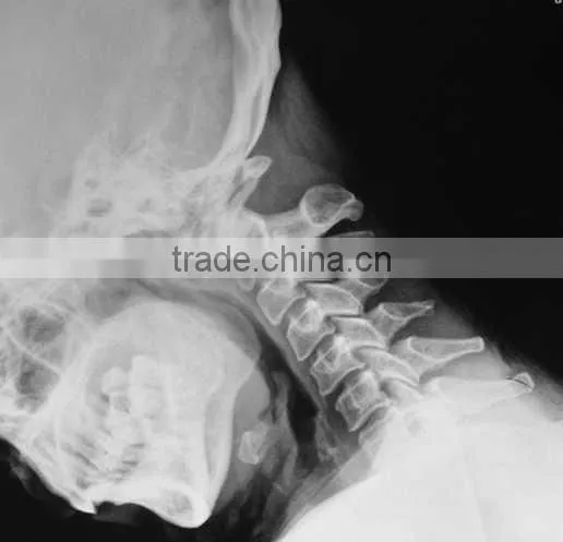 Imaging medical ray film,digital x-ray cr,fuji dry film with CE sale from manufacturer