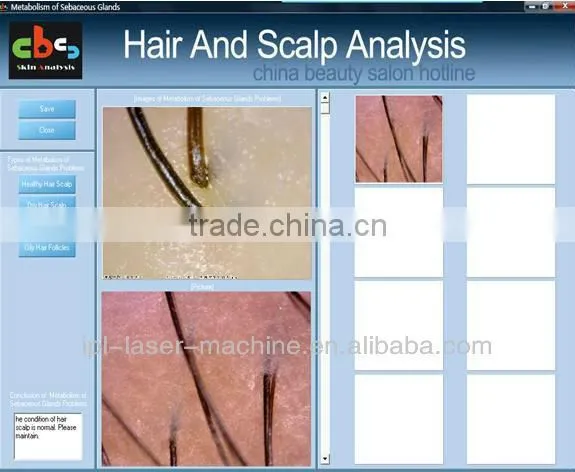 High definition hair analyzer mcahine
