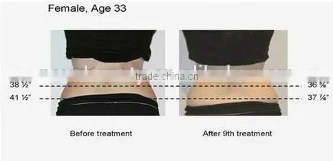 Alibaba China Suppier radio frequency?device photon light therapy machine cavitation slimming machine,New face NV-i3