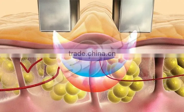 RF facial machine , ultra lipo cavitation rf beauty slimming machine