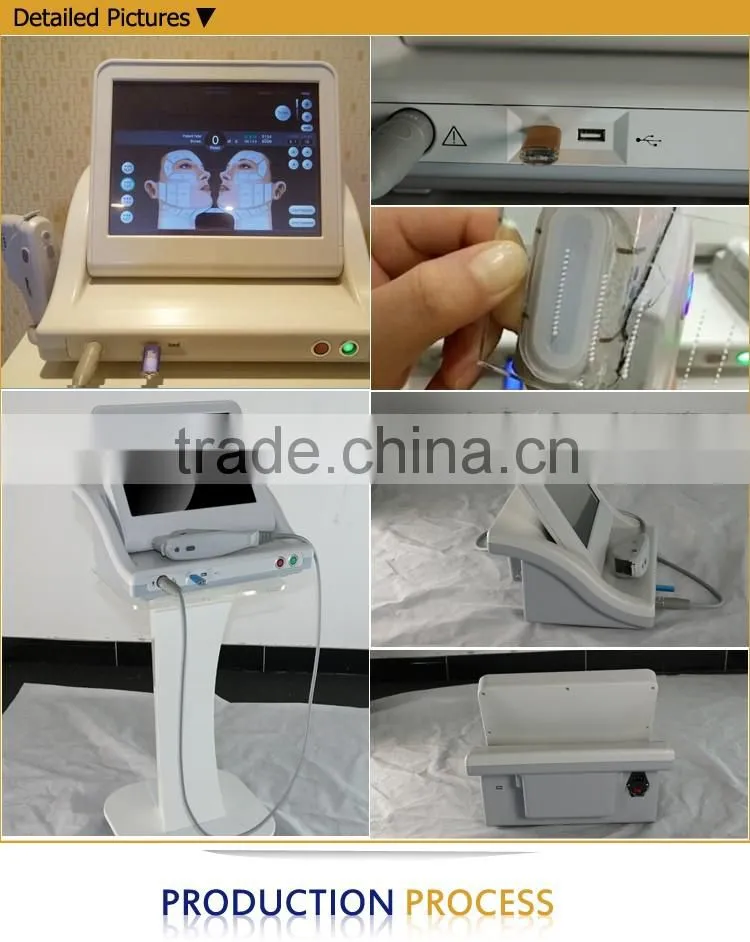 2016 best anti-wrinkle HIFU ultrasound therapy machine OD-H9