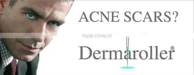 professional microneedle roller /magic anti ageing ,wrinkle removal,microneedle skin roller(CE approved)