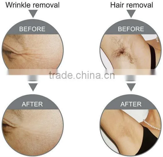 High performance chinese Multifunctional beauty machine
