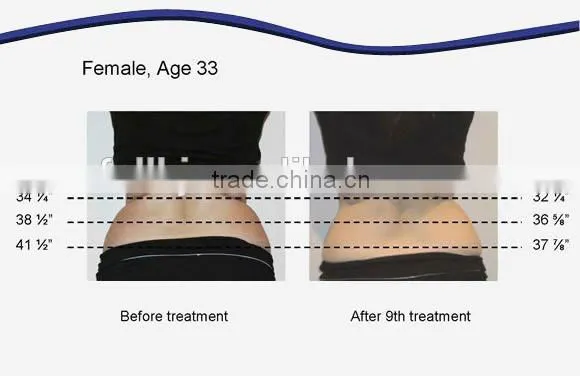 Lipo Laser fat melting machine body slimming machine