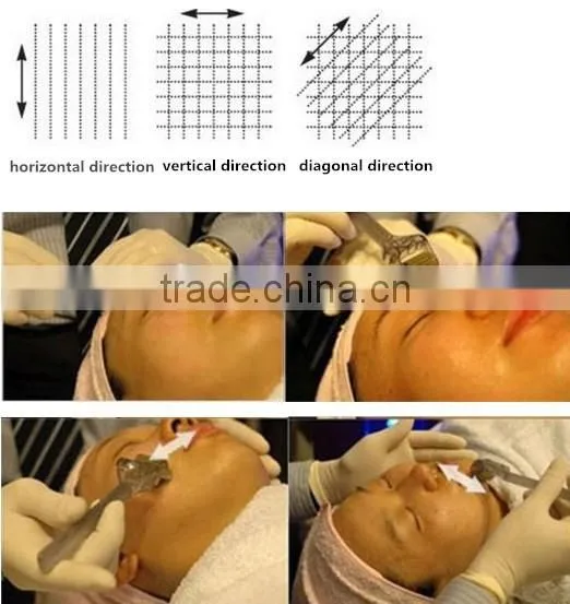 192 derma roller with hot sale