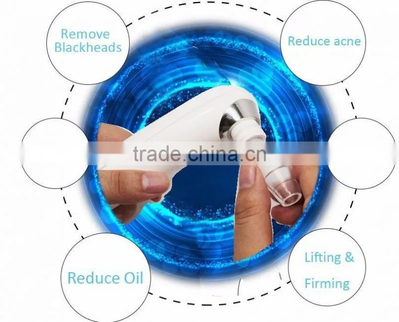 2017 Hot multifunction exfoliator vacuum blackhead remover for face