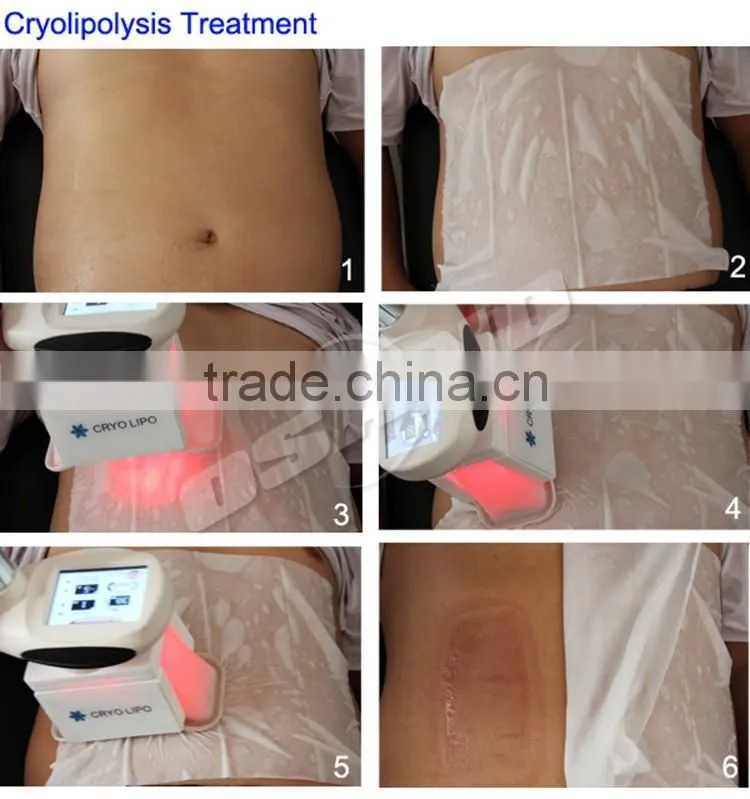 4 Handles Working Together Cryolipolysis Freeze Fat Slimming Machine