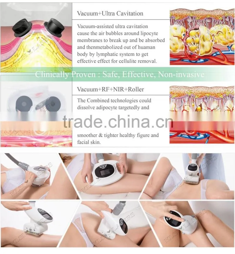 tighten the dilated pores swiss skin care Body Slimming Machine