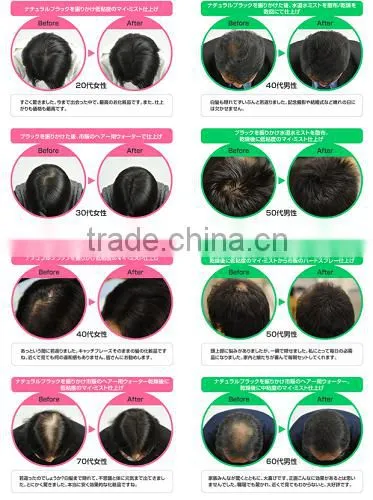 Best-selling and Healthy wigs for bald women with Flavorful made in Japan