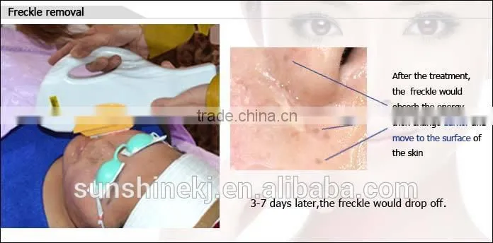 permanent hair removal machine for body beard and armpit hair