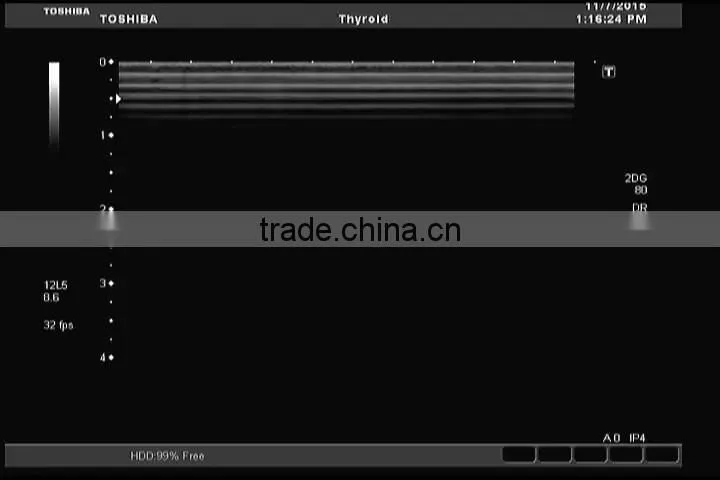 used Toshiba ultrasound linear probe PLT-805AT doppler color transducer