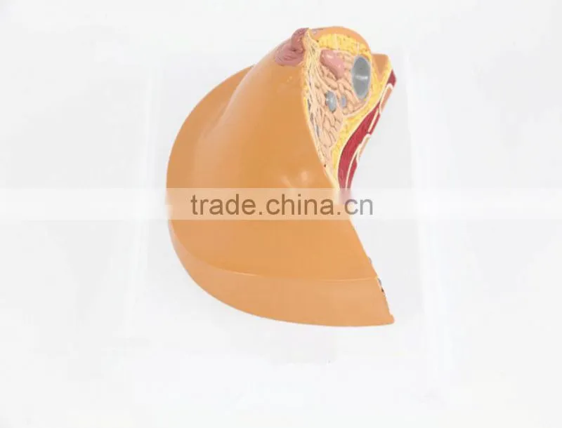Medical breast disease model breast anatomical model medical training model breast feeding model