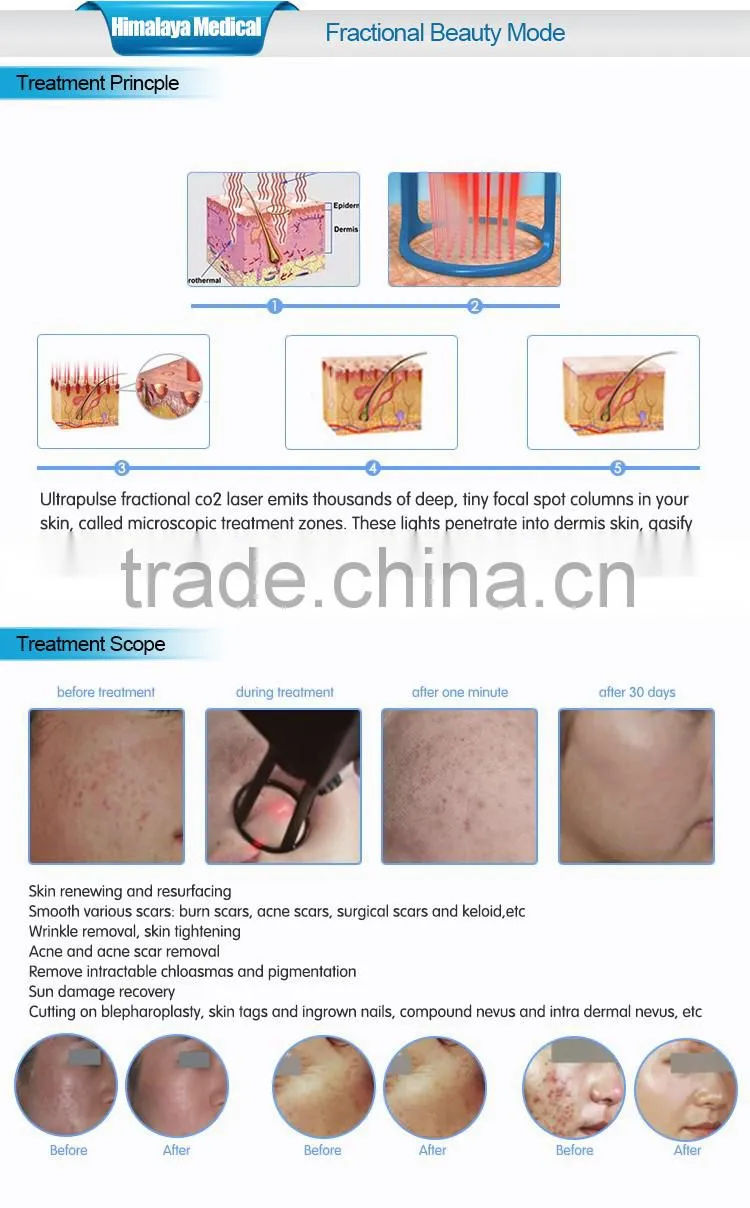 promotion! skin resurfacing fractional co2 laser equipment