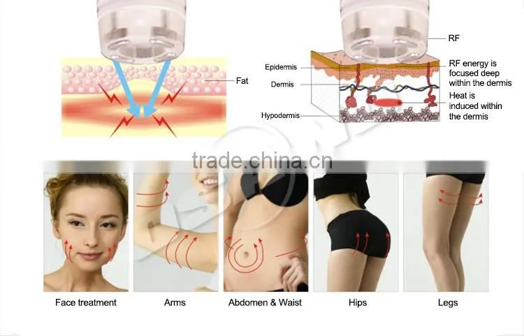 Ultrasonic Slimming Instrument Cavitation 40 khz Multipolar rf