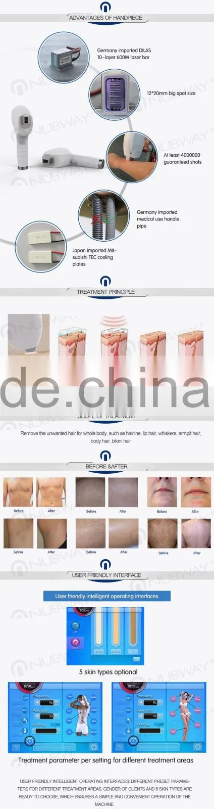 755nm alexandrite laser hair removal machine