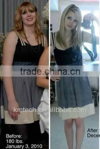 Factory outlets Free shipping !cavitacion ultrasonica