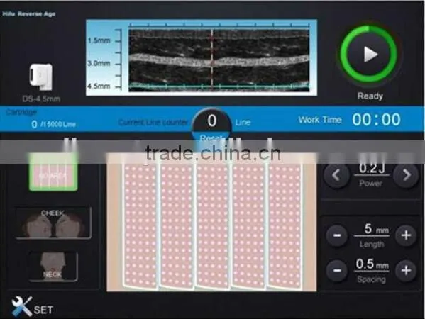 2015 professional portable HIFU High Intensity Focused Ultrasound HIFU with 3 tips for wrinkle removal