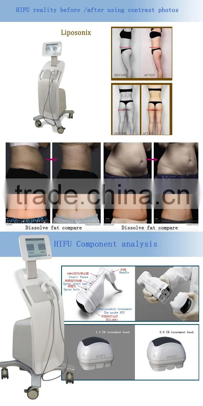 whole price ultrasound body slimming hifu ultra therapy