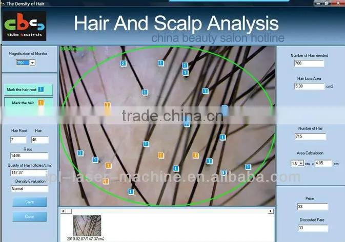 High definition hair analyzer mcahine
