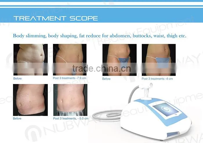 2015 leading body slimming spa use equipment HIFU ultrasound fat loss slimming device