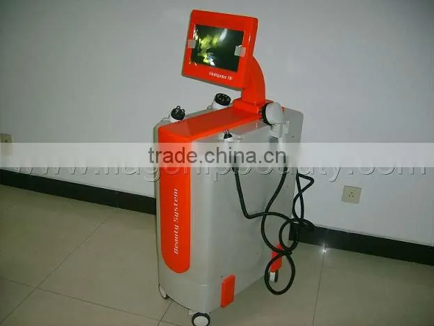 face lift skin rejuvenation machine popular radio frequency
