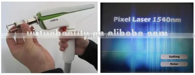 Scar removal skin resurfacing erbium laser machine