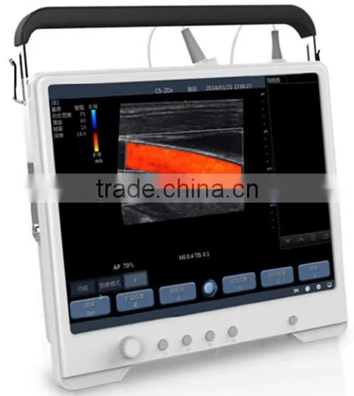 full touchscreen ultrasound handy machine made in China