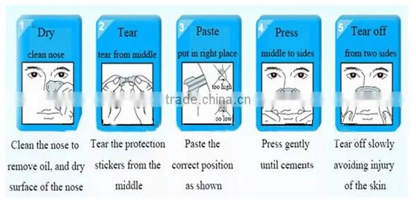 customized nasal strips oem snoring