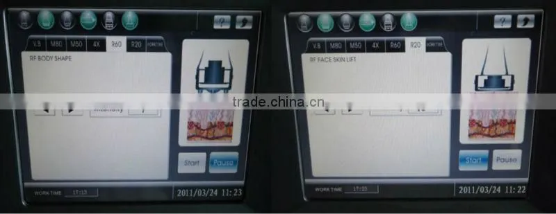 2013 Cavitation RF Ultrasonic machine S80C ISO/CE cavitation rf body sculpting