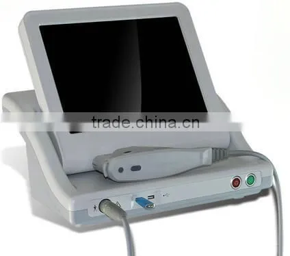 2015 Portable High Intensity focused ultrasound hifu therapy hifushape HIfu Slimming