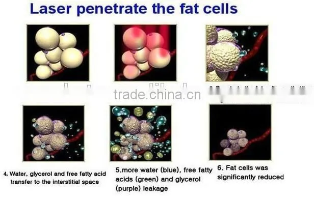 GuangZhou HETA Ultrasonic Cavitation RF and laser vacuum therapy cellulite machine