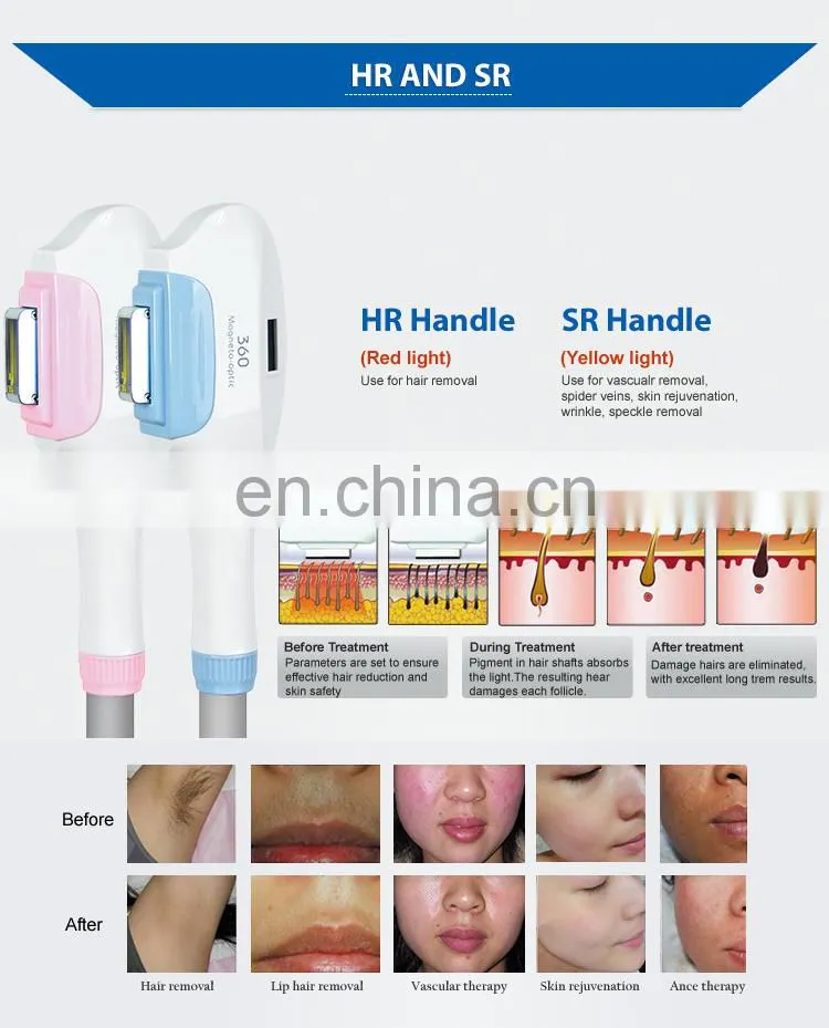 Double handle IPL OPT Rf Laser Hair Removal Depilatory Instrument Skin Rejuvenation Acne Removal Beauty Machine