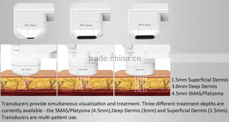 Portable HIFU beauty machine /China HIFU factory in quality HIFU technology deepth 4.5MM dermis effective HIFU results