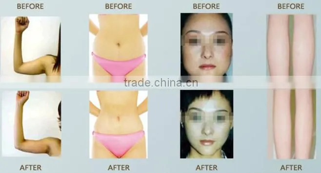 CE approve Vacuum Cavitation slimming machine/treatment for boday and face ,wrinkle removal ,skin care