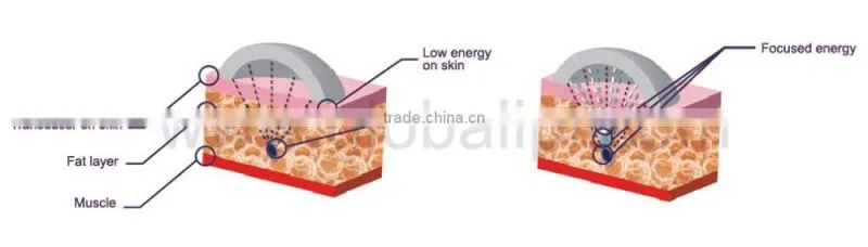 personal care explosive speed grease cavitation beauty machine with low price
