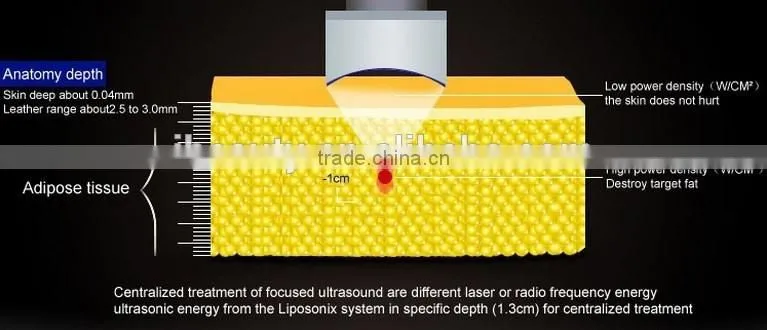 2016 the newest Lipo Hifu Sonic body fat break and skin tightening