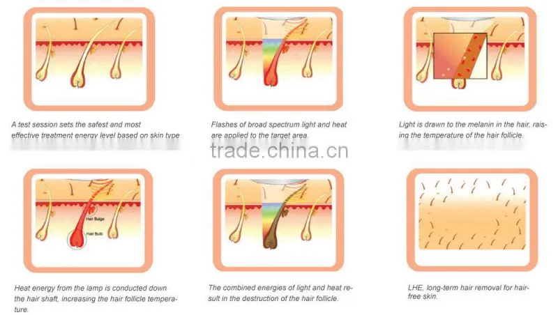 2015 BeiJing Fogool Professional depilacion laser 808 Diode body hair removers women