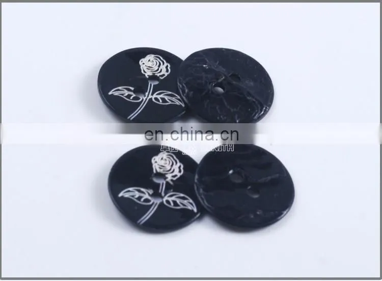 Custom Carving Natural Agoya Shell Button with Printing Flower BN80077