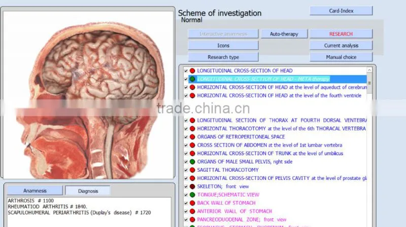 Hot selling 9DNLS quantum magnetic body health analyzer for household