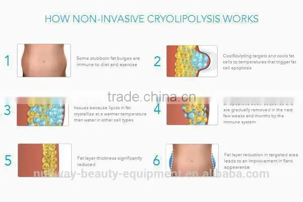 New Products For 2015 Fat Freeze Liposuction / Cryotherapy Slimming Machine