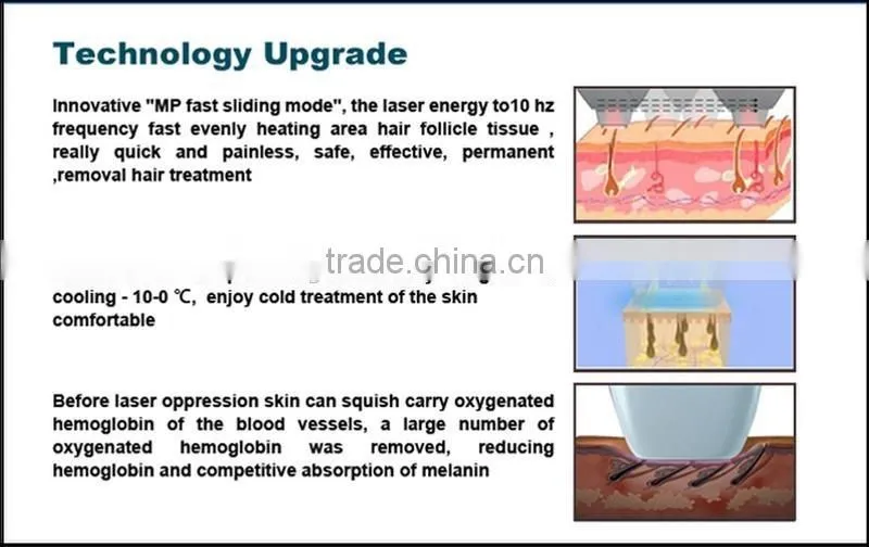 Super cooling! high quality diode 808nm laser hair remover / diode laser