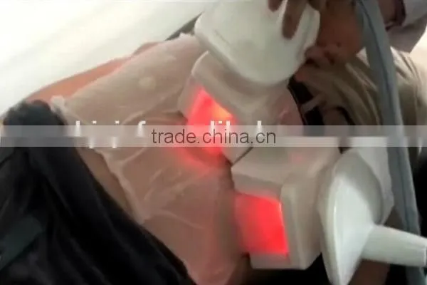 Freezefat anti-freezing membrane / Cryo slimming freeze membrane