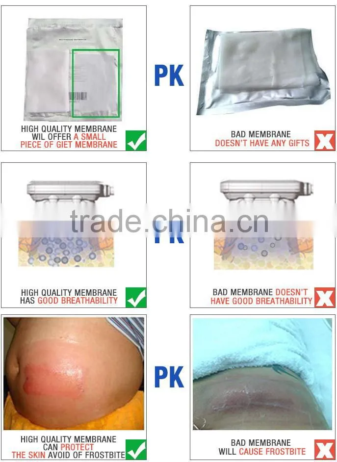 4 handle cryotherapy fat removal cryogenic freeze machinery medical cryo spa equipment