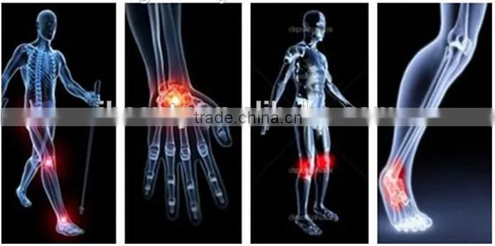 2016 new Physiotherapy extracorporeal shoulder pain therapy equipment shockwave machine