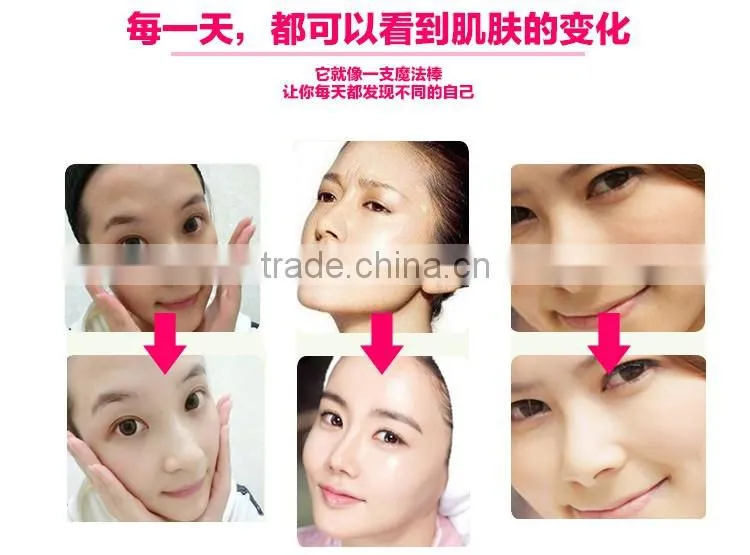 Direct manufacturer skin tightening collagen red light therapy for home with CE and ROSH